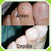 Foto 2 - Anncio 45-542093